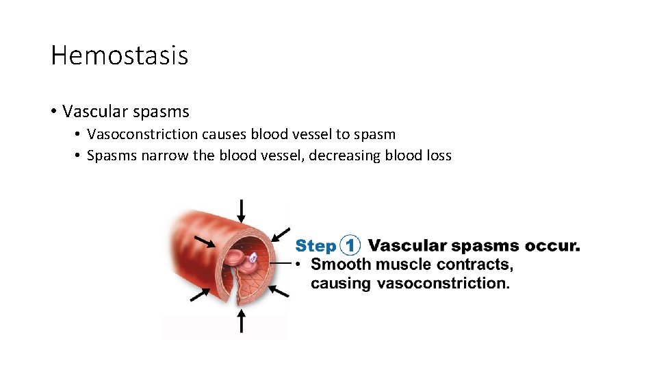 Hemostasis • Vascular spasms • Vasoconstriction causes blood vessel to spasm • Spasms narrow