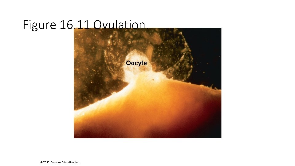 Figure 16. 11 Ovulation. Oocyte © 2018 Pearson Education, Inc. 