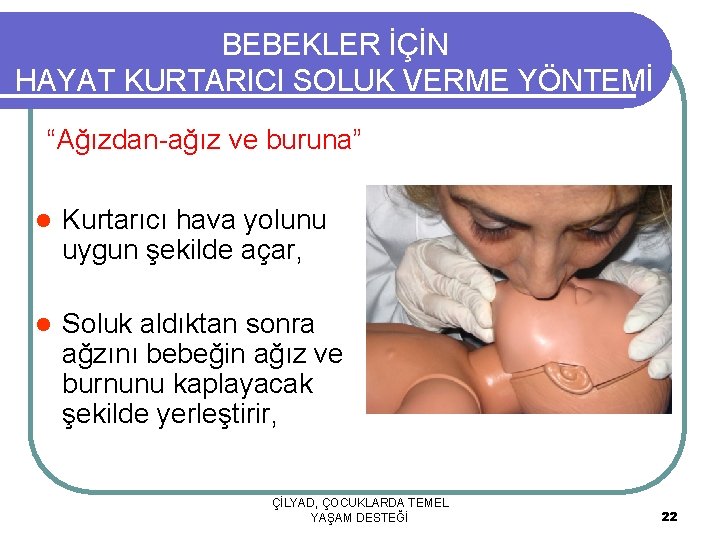 BEBEKLER İÇİN HAYAT KURTARICI SOLUK VERME YÖNTEMİ “Ağızdan-ağız ve buruna” l Kurtarıcı hava yolunu