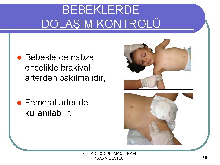 BEBEKLERDE DOLAŞIM KONTROLÜ l Bebeklerde nabza öncelikle brakiyal arterden bakılmalıdır, l Femoral arter de