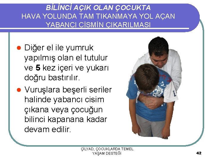 BİLİNCİ AÇIK OLAN ÇOCUKTA HAVA YOLUNDA TAM TIKANMAYA YOL AÇAN YABANCI CİSMİN ÇIKARILMASI Diğer