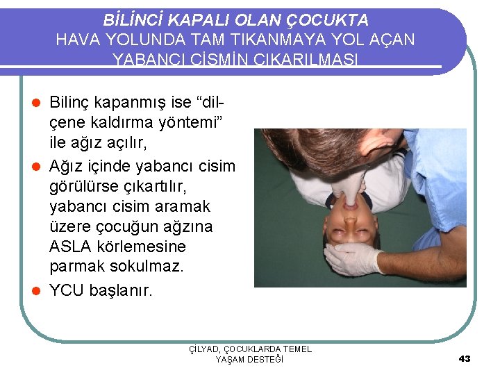 BİLİNCİ KAPALI OLAN ÇOCUKTA HAVA YOLUNDA TAM TIKANMAYA YOL AÇAN YABANCI CİSMİN ÇIKARILMASI Bilinç