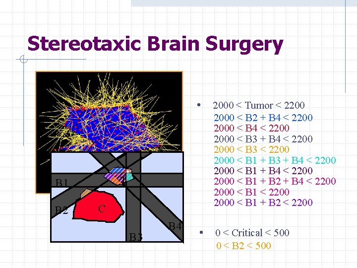 Stereotaxic Brain Surgery 2000 < Tumor < 2200 2000 < B 2 + B