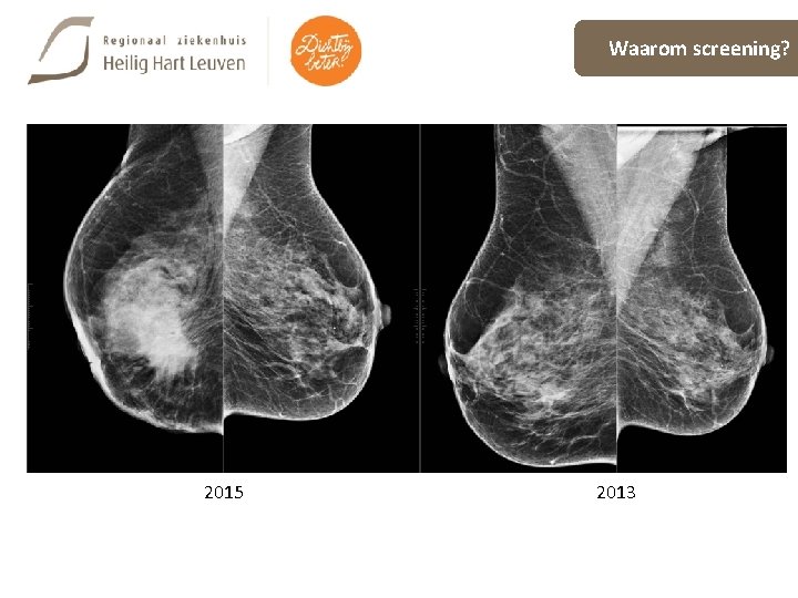 Waarom screening? 2015 2013 