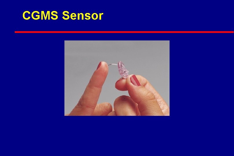 CGMS Sensor 