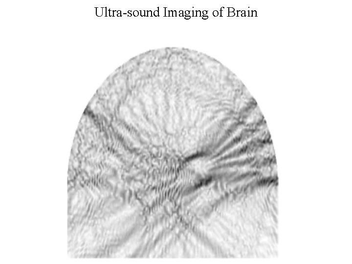 Ultra-sound Imaging of Brain 