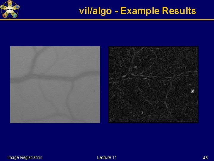 vil/algo - Example Results Image Registration Lecture 11 43 