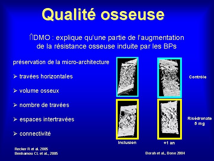 Qualité osseuse DMO : explique qu’une partie de l’augmentation de la résistance osseuse induite