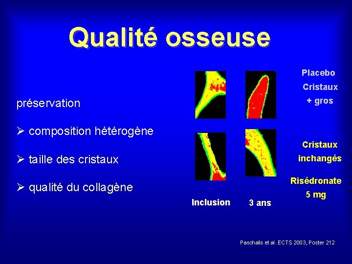 Qualité osseuse Placebo Cristaux + gros préservation Ø composition hétérogène Cristaux Ø taille des