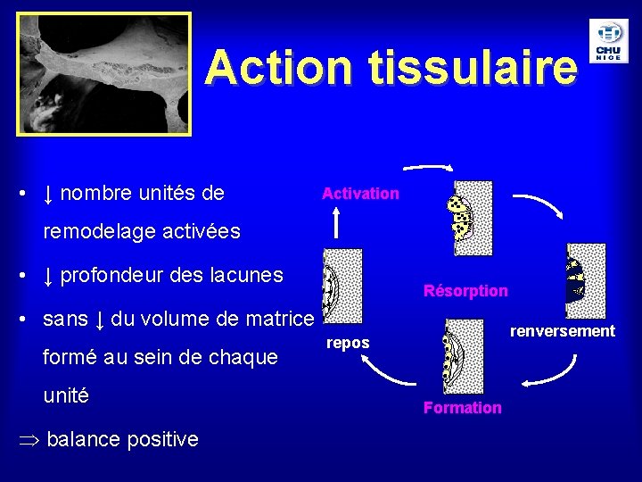 Action tissulaire • ↓ nombre unités de Activation remodelage activées • ↓ profondeur des