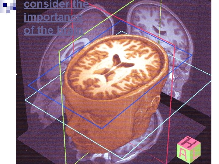 consider the importance of the brain 