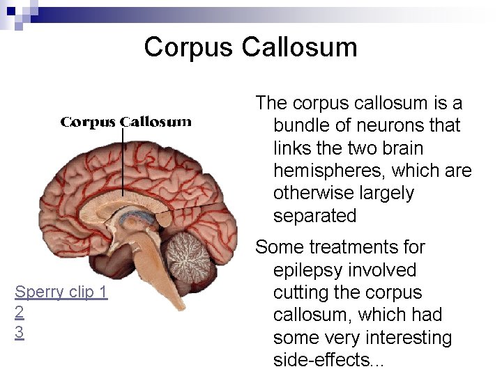 Corpus Callosum The corpus callosum is a bundle of neurons that links the two