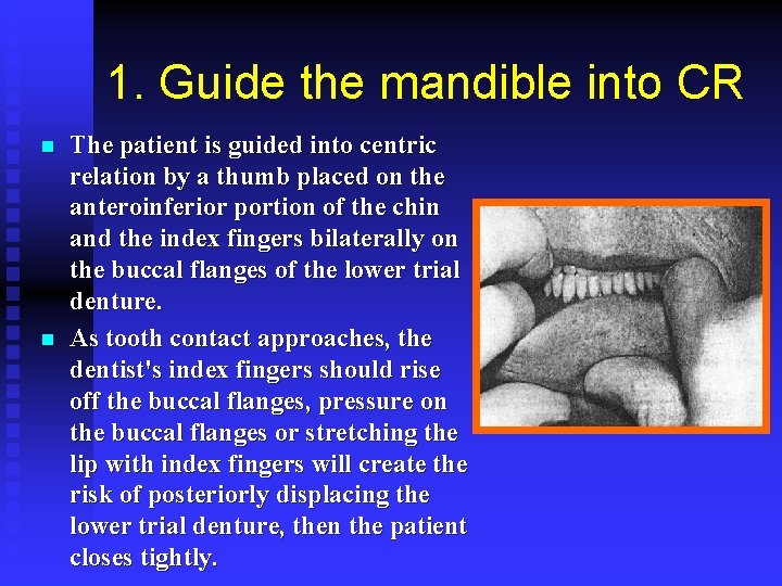1. Guide the mandible into CR n n The patient is guided into centric