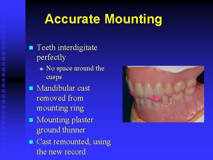 Accurate Mounting n Teeth interdigitate perfectly u n n n No space around the