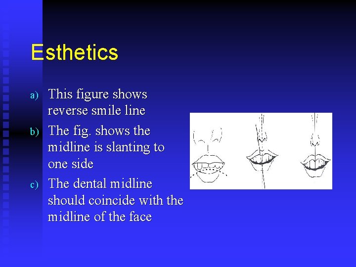 Esthetics a) b) c) This figure shows reverse smile line The fig. shows the
