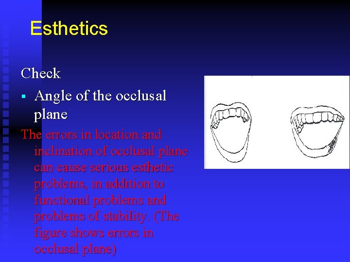 Esthetics Check § Angle of the occlusal plane The errors in location and inclination