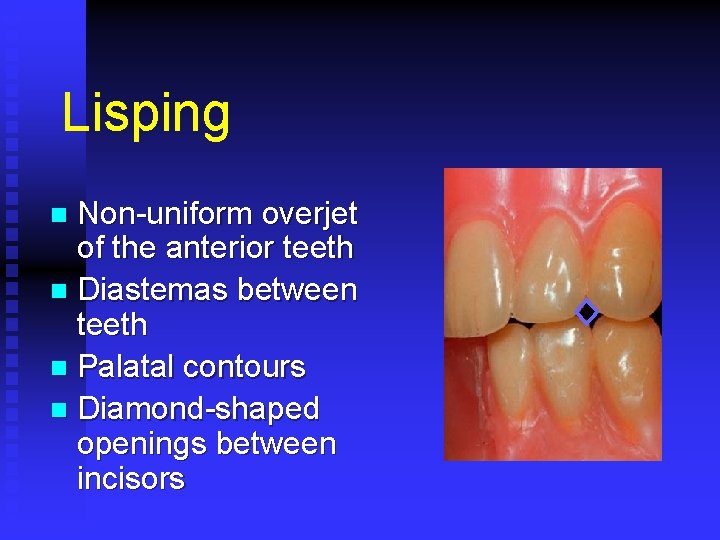 Lisping Non-uniform overjet of the anterior teeth n Diastemas between teeth n Palatal contours