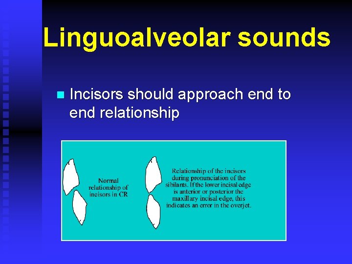 Linguoalveolar sounds n Incisors should approach end to end relationship 