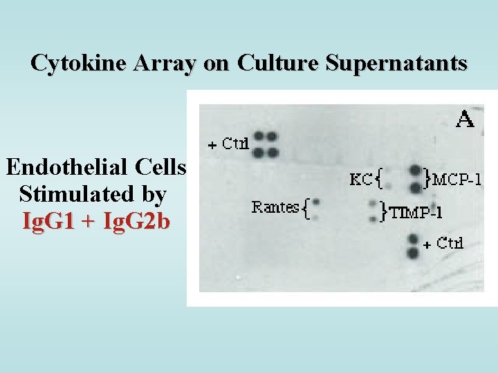 Cytokine Array on Culture Supernatants Endothelial Cells Stimulated by Ig. G 1 + Ig.