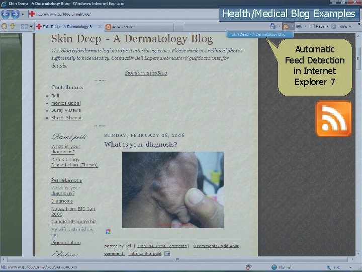 Health/Medical Blog Examples Automatic Feed Detection in Internet Explorer 7 