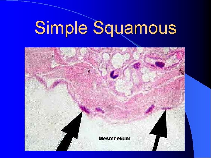 Simple Squamous 