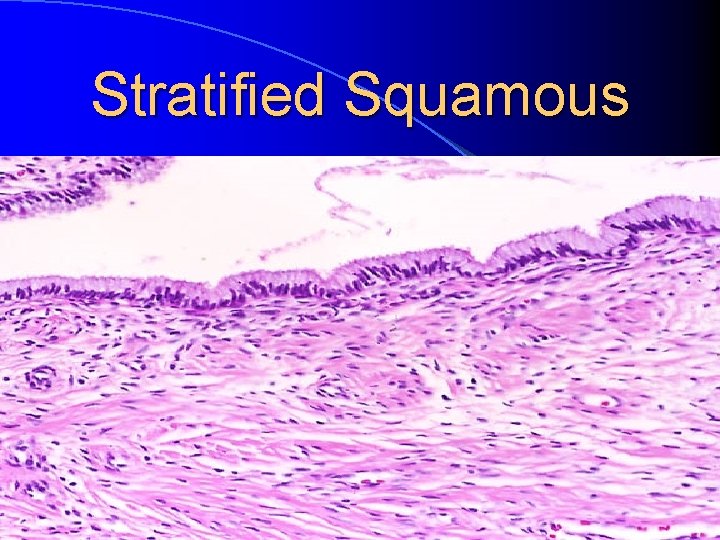 Stratified Squamous 