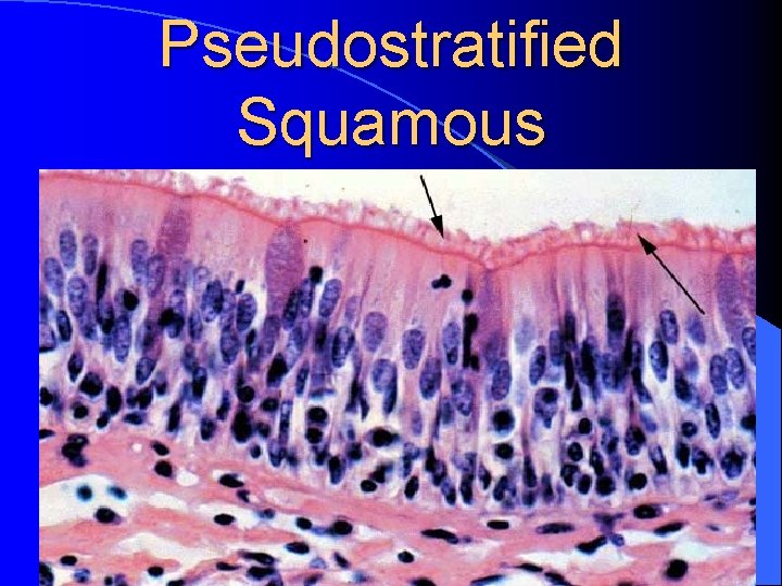 Pseudostratified Squamous 