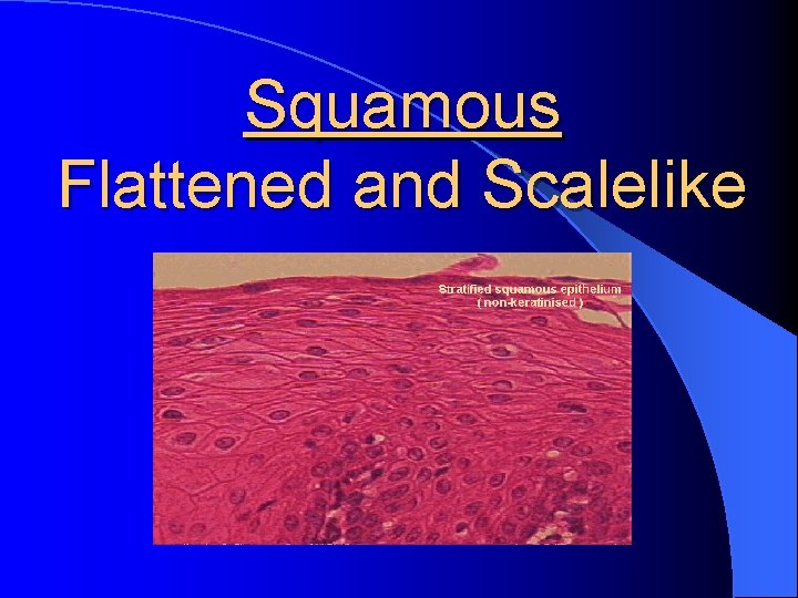 Squamous Flattened and Scalelike 