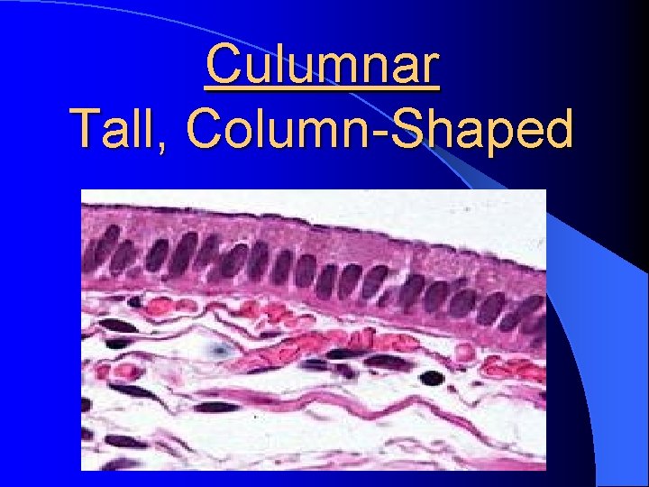 Culumnar Tall, Column-Shaped 