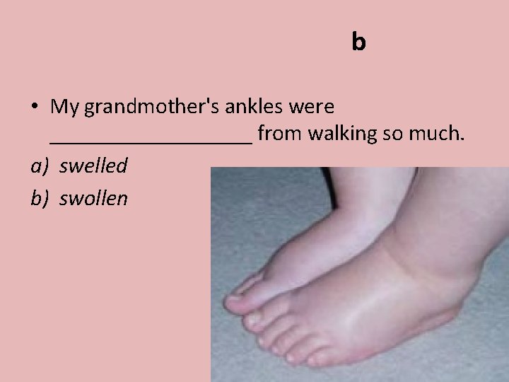 b • My grandmother's ankles were _________ from walking so much. a) swelled b)