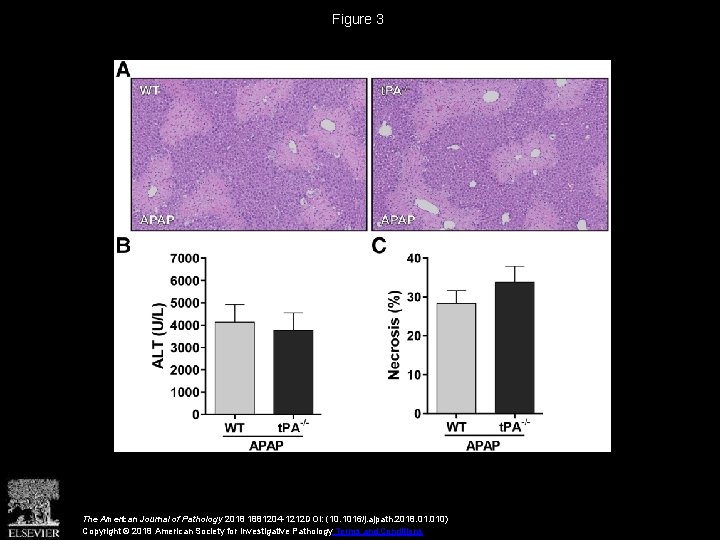 Figure 3 The American Journal of Pathology 2018 1881204 -1212 DOI: (10. 1016/j. ajpath. Figure 3 The American Journal of Pathology 2018 1881204 -1212 DOI: (10. 1016/j. ajpath.