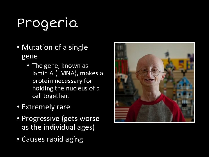 Progeria • Mutation of a single gene • The gene, known as lamin A