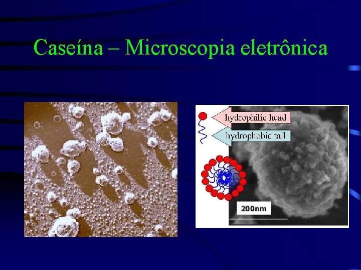 Caseína – Microscopia eletrônica 