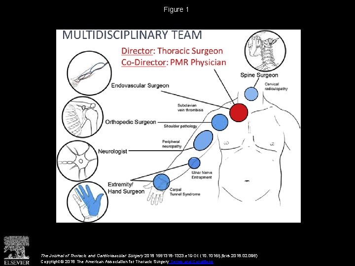 Figure 1 The Journal of Thoracic and Cardiovascular Surgery 2018 1561318 -1323. e 1