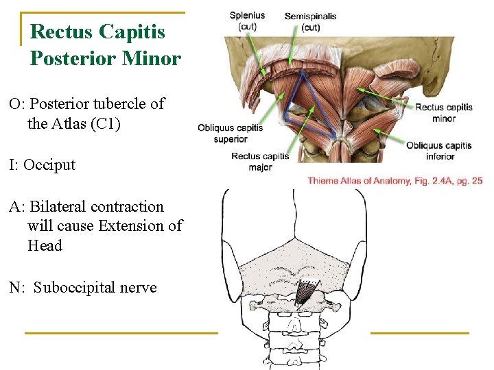 Rectus Capitis Posterior Minor O: Posterior tubercle of the Atlas (C 1) I: Occiput