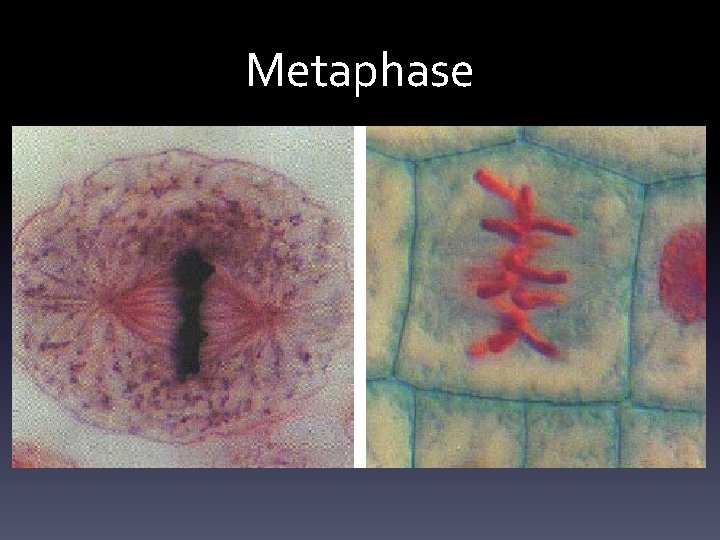 Metaphase 