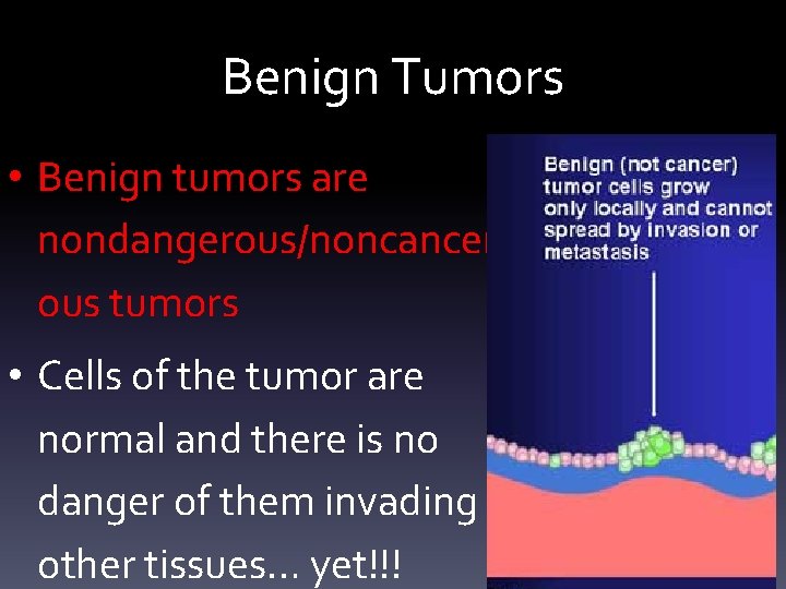 Benign Tumors • Benign tumors are nondangerous/noncancer ous tumors • Cells of the tumor
