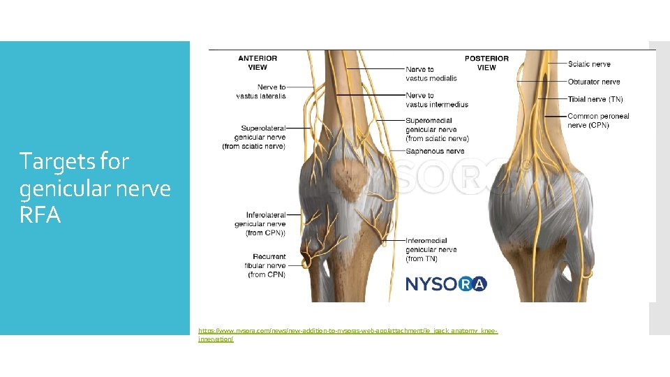 Targets for genicular nerve RFA https: //www. nysora. com/news/new‐addition‐to‐nysoras‐web‐app/attachment/le_ipack_anatomy_knee‐ innervation/ 