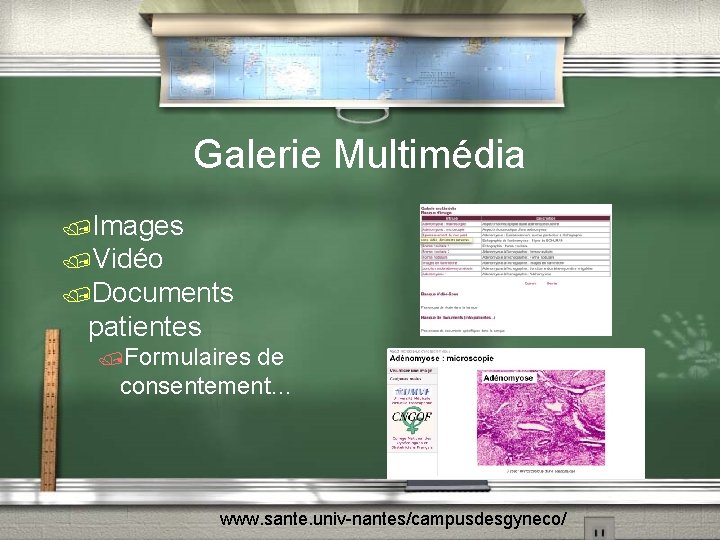 Galerie Multimédia /Images /Vidéo /Documents patientes /Formulaires de consentement… www. sante. univ-nantes/campusdesgyneco/ 