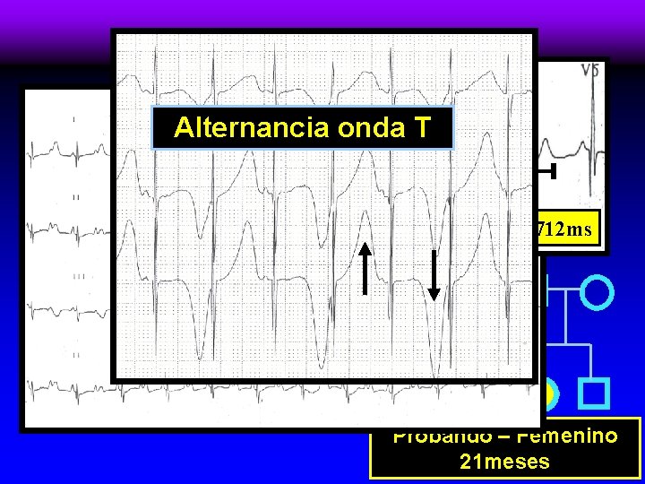 Arbol Familiar Alternancia onda T 35 años 8 años Bloqueo AV 2: 1 Muerte
