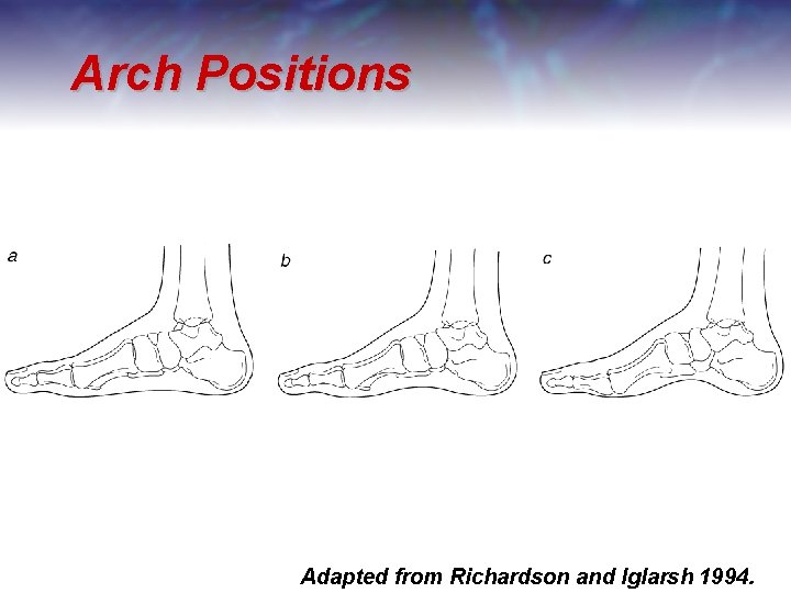 Arch Positions Adapted from Richardson and Iglarsh 1994. 