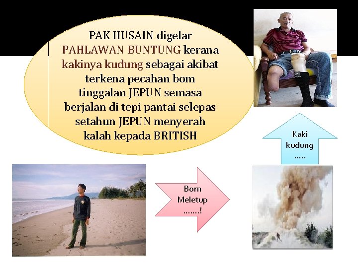 PAK HUSAIN digelar PAHLAWAN BUNTUNG kerana kakinya kudung sebagai akibat terkena pecahan bom tinggalan