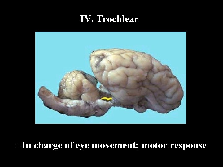 IV. Trochlear - In charge of eye movement; motor response 