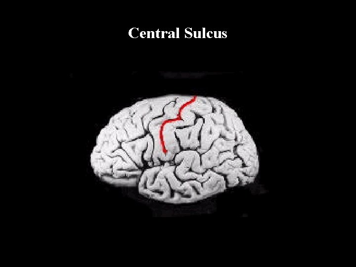 Central Sulcus 