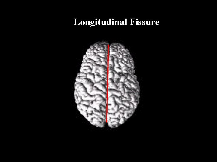 Longitudinal Fissure 