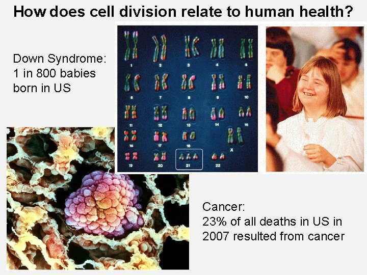 How does cell division relate to human health? Down Syndrome: 1 in 800 babies
