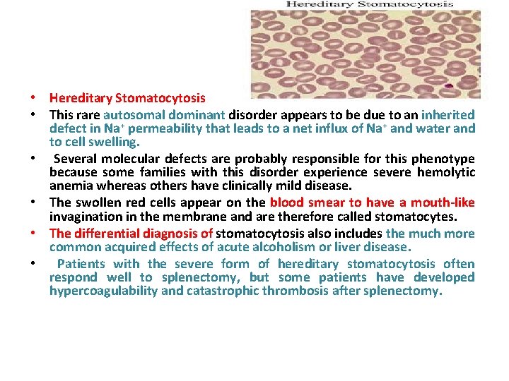  • Hereditary Stomatocytosis • This rare autosomal dominant disorder appears to be due