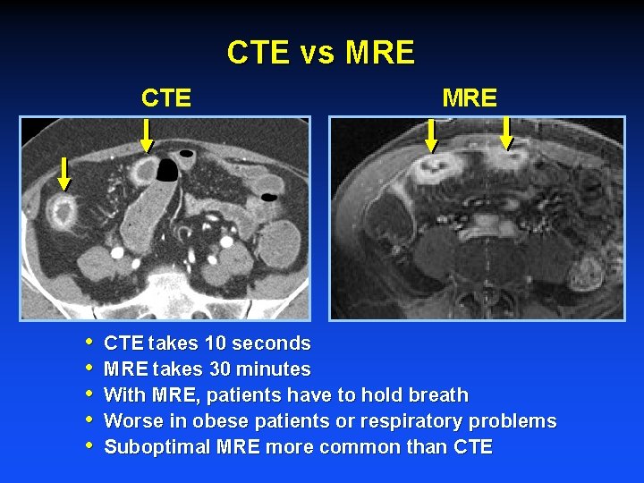 CTE vs MRE CTE • • • MRE CTE takes 10 seconds MRE takes