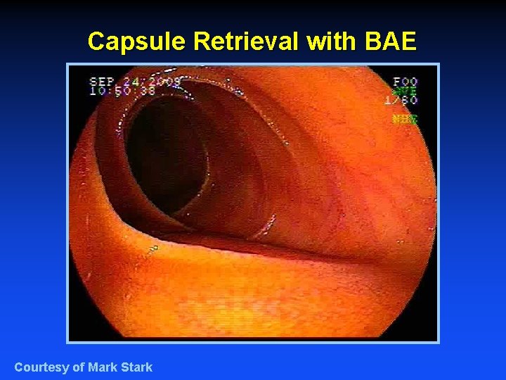 Capsule Retrieval with BAE Courtesy of Mark Stark 