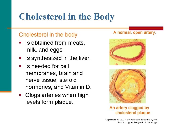 Cholesterol in the Body Cholesterol in the body § Is obtained from meats, milk,